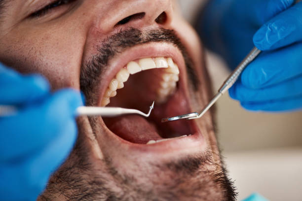 Best Pediatric Emergency Dentist in East Peoria, IL